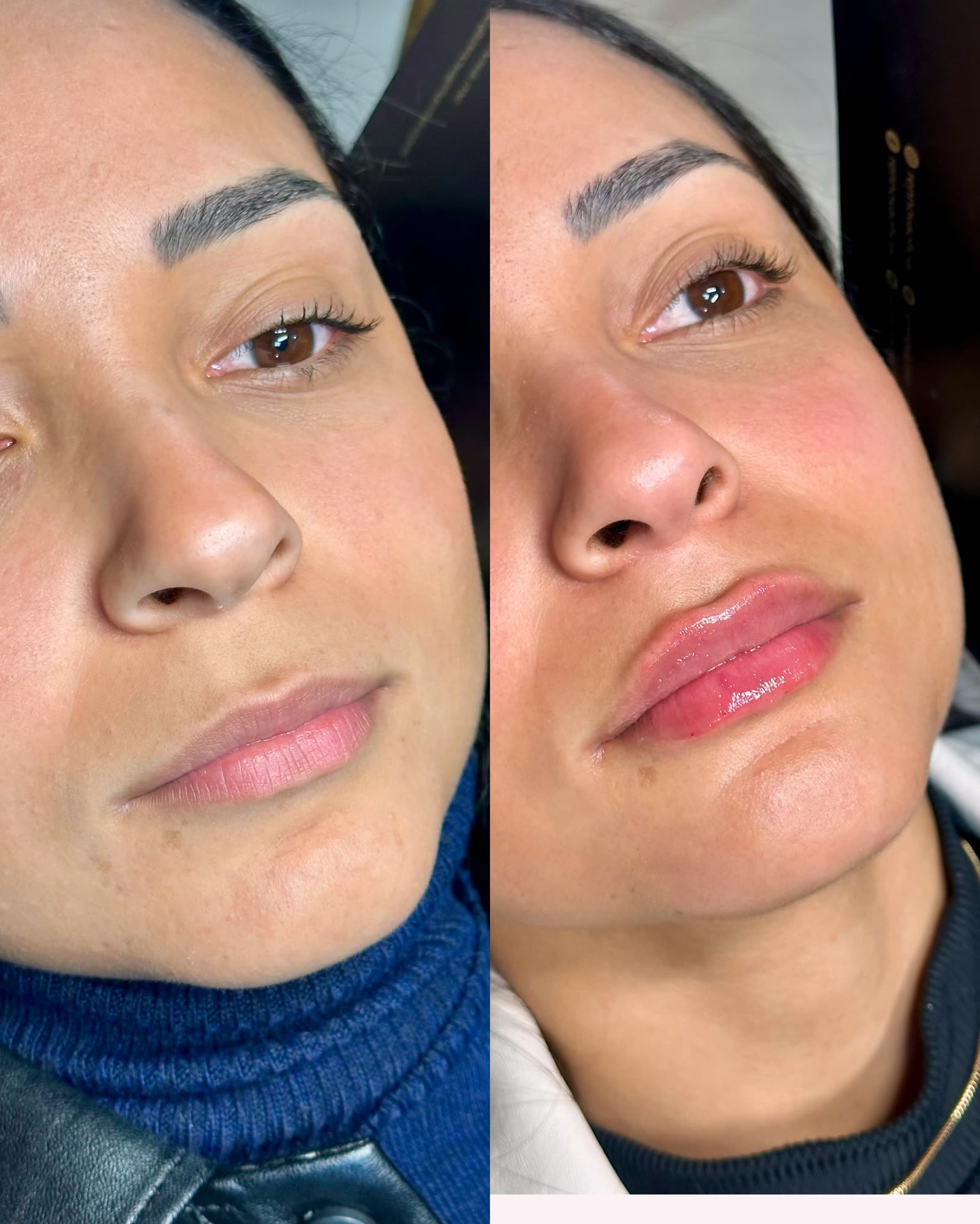 Caso clínico 2